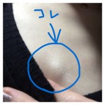 【体験記】30代の乳がん検査~二度目のご報告